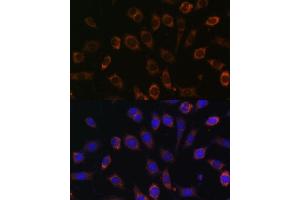 Immunofluorescence analysis of L929 cells using TCIRG1 Polyclonal Antibody (ABIN7270707) at dilution of 1:100 (40x lens). (TCIRG1 抗体  (AA 1-130))