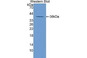 Western blot analysis of the recombinant protein. (LDHB 抗体  (AA 1-334))