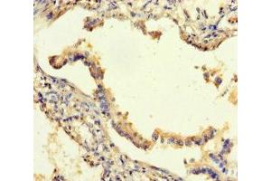Immunohistochemistry (IHC) image for anti-Sema Domain, Seven thrombospondin Repeats (Type 1 and Type 1-Like), Transmembrane Domain (TM) and Short Cytoplasmic Domain, (Semaphorin) 5A (SEMA5A) (AA 201-400) antibody (ABIN7168811)