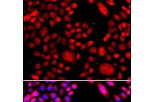 Immunofluorescence analysis of A549 cells using RAC3 Polyclonal Antibody (RAC3 抗体)