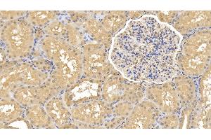 Detection of RNLS in Human Kidney Tissue using Monoclonal Antibody to Renalase (RNLS)