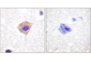 Immunohistochemistry analysis of paraffin-embedded human brain tissue, using Catalase (Ab-385) Antibody. (Catalase 抗体  (AA 361-410))