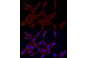 Immunofluorescence analysis of PC-12 cells using PLK2 Rabbit pAb (ABIN6132905, ABIN6145776, ABIN6145778 and ABIN6222860) at dilution of 1:150 (40x lens). (PLK2 抗体  (AA 322-671))