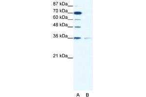 WB Suggested Anti-ZNF326 Antibody Titration: 1. (ZNF326 抗体  (C-Term))