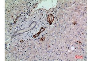 Immunohistochemistry (IHC) analysis of paraffin-embedded Human Liver, antibody was diluted at 1:100. (RHAG 抗体  (N-Term))