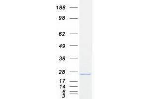 Western Blotting (WB) image for Calcium and Integrin-Binding Protein 1 (CIB1) protein (Myc-DYKDDDDK Tag) (ABIN2714191)
