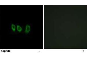Immunofluorescence analysis of A-549 cells, using CSTL1 polyclonal antibody . (CSTL1 抗体)