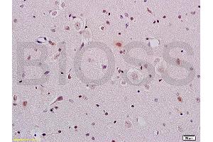 Formalin-fixed and paraffin embedded rat brain tissue labeled with Anti-ERCC1 Polyclonal Antibody, Unconjugated (ABIN733553) at 1:200 followed by conjugation to the secondary antibody and DAB staining (ERCC1 抗体  (AA 151-250))