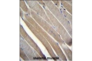 TRMT2B Antibody (N-term) (ABIN655117 and ABIN2844748) immunohistochemistry analysis in formalin fixed and paraffin embedded human skeletal muscle followed by peroxidase conjugation of the secondary antibody and DAB staining. (TRMT2B 抗体  (N-Term))