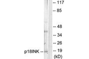 Western blot analysis of extracts from COS7 cells, using p18 INK Antibody. (P18 INK 抗体  (AA 111-160))