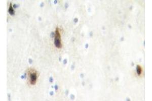 Immunohistochemistry analyzes of MVK antibody in paraffin-embedded human brain tissue. (MVK 抗体)