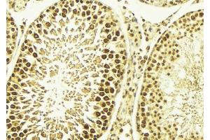 ABIN6267669 at 1/100 staining Mouse testis tissue by IHC-P. (CAMK4 抗体  (pThr200))