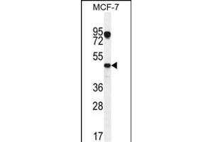 VEGF3 Antibody (N-term) (ABIN655891 and ABIN2845292) western blot analysis in MCF-7 cell line lysates (35 μg/lane). (VEGFC 抗体  (N-Term))