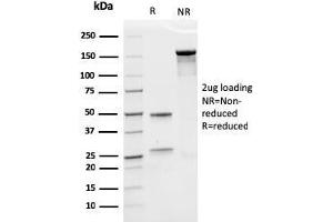 SDS-PAGE Analysis Purified EPO Recombinant Mouse Monoclonal Antibody (rEPO/1367). (Recombinant EPO 抗体  (AA 28-162))