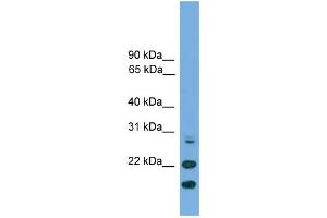 WB Suggested Anti-ASF1A Antibody Titration: 0. (ASF1A 抗体  (N-Term))