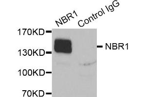 Immunoprecipitation analysis of extracts of K562 cells, using NBR1 antibody (ABIN5972123). (NBR1 抗体)