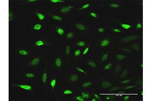Immunofluorescence of purified MaxPab antibody to EPB41L1 on HeLa cell. (EPB41L1 抗体  (AA 1-779))