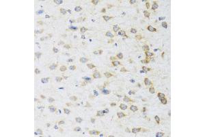 Immunohistochemistry of paraffin-embedded mouse brain using STRN antibody (ABIN5975752) at dilution of 1/100 (40x lens). (Striatin 抗体)