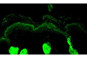 Immunohistochemistry analysis using Rabbit Anti-Calreticulin Polyclonal Antibody . (Calreticulin 抗体  (PE))