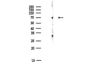 anti-Guanylate Binding Protein 1, Interferon-Inducible (GBP1) (C-Term) antibody