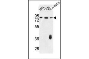 Western blot analysis of F12 Antibody (N-term) in K562,CEM,MDA-MB435 cell line lysates (35ug/lane). (F12 抗体  (N-Term))
