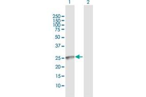 Western Blot analysis of GALNT9 expression in transfected 293T cell line by GALNT9 MaxPab polyclonal antibody. (GALNT9 抗体  (AA 1-237))