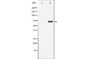 Western Blotting (WB) image for anti-V-Rel Reticuloendotheliosis Viral Oncogene Homolog B (RELB) (pSer573) antibody (ABIN6255407)