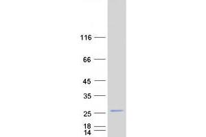 RAB25 Protein (Myc-DYKDDDDK Tag)