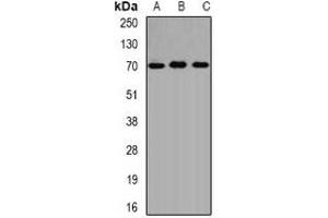 Western blot analysis of ALAS-H expression in SW620 (A), HepG2 (B), mouse liver (C) whole cell lysates. (ALAS1 抗体)