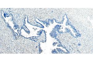 ABIN334371 Negative Control showing staining of paraffin embedded Human Prostate, with no primary antibody.