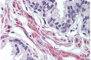 Human Prostate (formalin-fixed, paraffin-embedded) stained with FNTA antibody ABIN298038 at 10 ug/ml followed by biotinylated goat anti-rabbit IgG secondary antibody ABIN481713, alkaline phosphatase-streptavidin and chromogen. (FNTA 抗体  (AA 150-250))