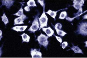Immunofluorescence staining of mouse macrophages. (NAT1 抗体  (AA 672-830))