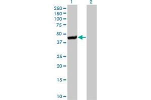 Western Blot analysis of CTH expression in transfected 293T cell line by CTH monoclonal antibody (M01A), clone 4E1-1B7. (CTH 抗体  (AA 1-405))