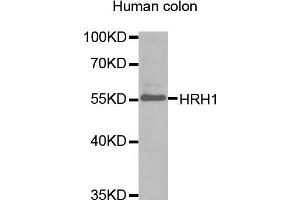 Western blot analysis of extracts of human colon, using HRH1 antibody (ABIN1873083).