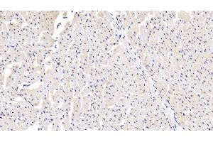 Detection of SSA1 in Human Cardiac Muscle Tissue using Polyclonal Antibody to Sjogren Syndrome Antigen A1 (SSA1) (TRIM21 抗体  (AA 268-465))