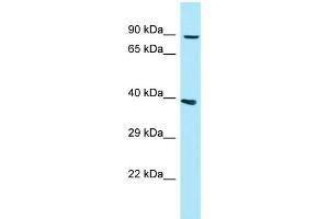 WB Suggested Anti-GPLD1 Antibody Titration: 1. (GPLD1 抗体  (N-Term))