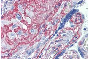 Anti-Collagen IV antibody IHC staining of human placenta. (Collagen IV 抗体)