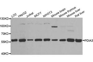 Western blot analysis of extracts of various cell lines, using PDIA3 antibody (ABIN5970443) at 1/1000 dilution. (PDIA3 抗体)