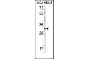 Western blot analysis in of DTWD1 Antibody (Center) Cat. (DTWD1 抗体  (Middle Region))
