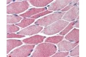 Immunohistochemistry (IHC) image for anti-BTB and CNC Homology 1, Basic Leucine Zipper Transcription Factor 1 (BACH1) (AA 92-104) antibody (ABIN2470198)