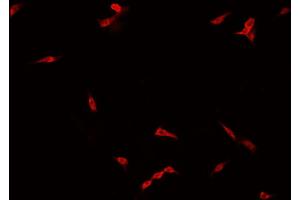 ABIN6266775 staining NCI-H929 cells by IF/ICC. (FOXH1 抗体  (Internal Region))