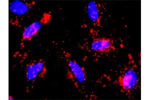 Proximity Ligation Analysis of protein-protein interactions between PIK3R1 and CTNNB1. (CTNNB1 抗体  (AA 682-781))