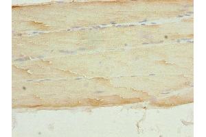 Immunohistochemistry of paraffin-embedded human skeletal muscle tissue using ABIN7146581 at dilution of 1:100 (Calsequestrin 抗体  (AA 127-396))