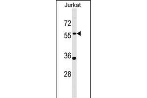 NX1 Antibody (Center) (ABIN1537796 and ABIN2848757) western blot analysis in Jurkat cell line lysates (35 μg/lane). (PANX1 抗体  (AA 124-152))