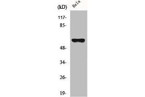 Western Blot analysis of HeLa cells using CYP27A1 Polyclonal Antibody (CYP27A1 抗体  (Internal Region))