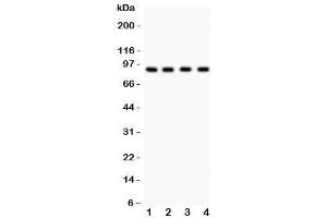 Western blot testing of Furin antibody and Lane 1:  HeLa (FURIN 抗体  (AA 591-794))