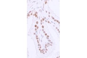 Immunohistochemistry (IHC) image for anti-Tumor Protein P53 Binding Protein 1 (TP53BP1) (AA 350-400) antibody (ABIN7448396) (TP53BP1 抗体  (AA 350-400))