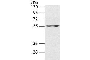 Western Blot analysis of PC3 cell using UBP1 Polyclonal Antibody at dilution of 1:200 (UBP1 抗体)