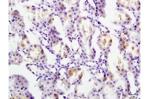Formalin-fixed and paraffin embedded rat kidney tissue labeled with Anti Ferritin Polyclonal Antibody, Unconjugated  at 1:200 followed by conjugation to the secondary antibody and DAB staining (FTH1 抗体  (AA 1-100))