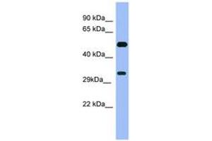 Image no. 1 for anti-Melanoma Antigen Family B, 1 (MAGEB1) (C-Term) antibody (ABIN6741714) (MAGEB1 抗体  (C-Term))